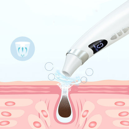 Revitalize Your Skin: Electric Blackhead Suction Cleanser for Professional Skin Care - Jinus Emporium